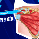 kenali dan atasi cedera otot