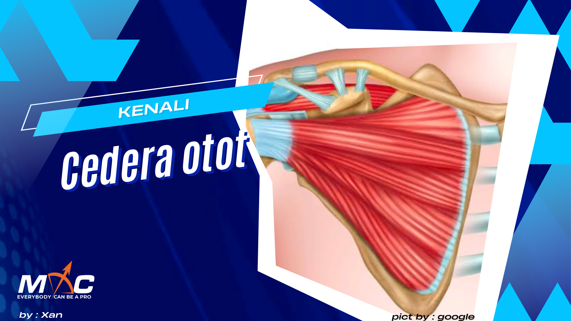 kenali dan atasi cedera otot